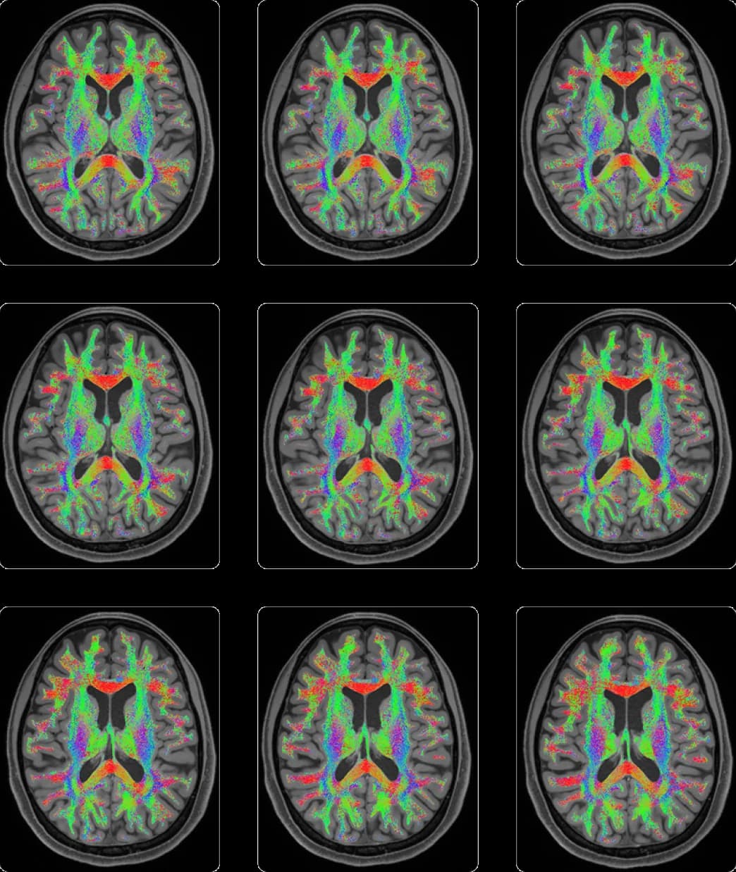 Diffusion tensor imaging tractography across nine axial brain slices, with white-matter tracts colour-coded by orientation.